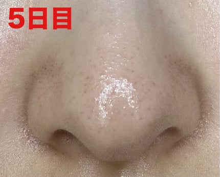 泥ジェル洗顔/ファンケル/その他洗顔料を使ったクチコミ(7枚目)