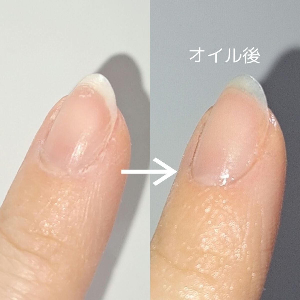 甘皮ケアオイル/無印良品/ネイルオイル・トリートメントを使ったクチコミ(3枚目)