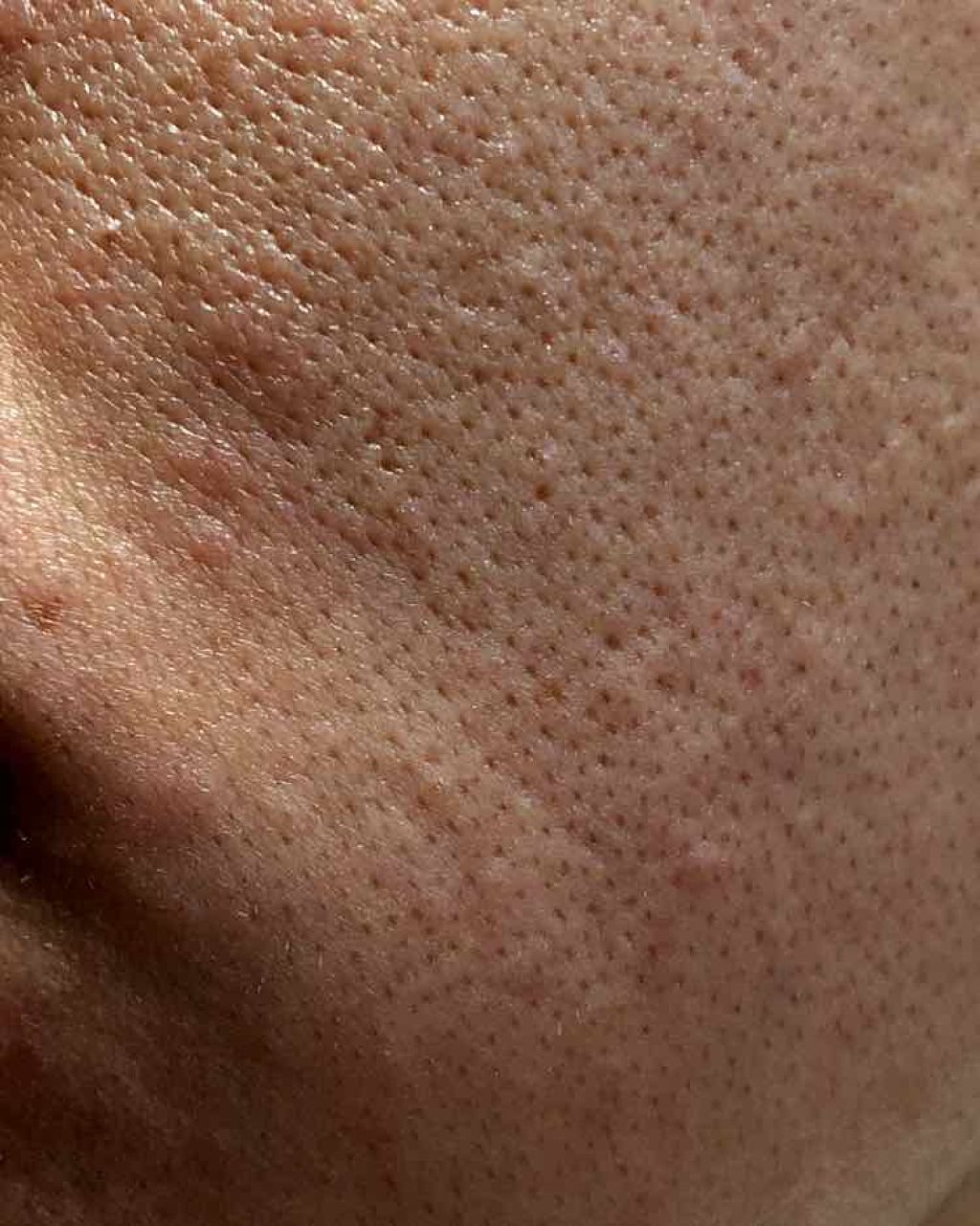 Cセラム/b.glen/美容液を使ったクチコミ(4枚目)