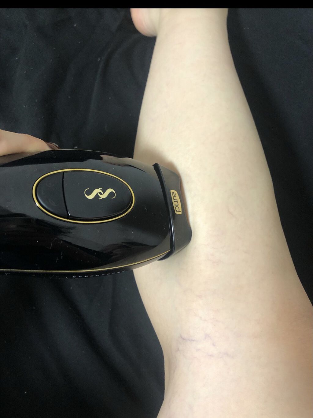 スムーズスキン pure fit/スムーズスキン/家庭用脱毛器を使ったクチコミ（2枚目）