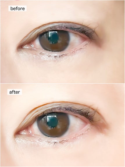 マイクロファイバー /ビー・エヌ/二重まぶた用アイテムを使ったクチコミ(3枚目)