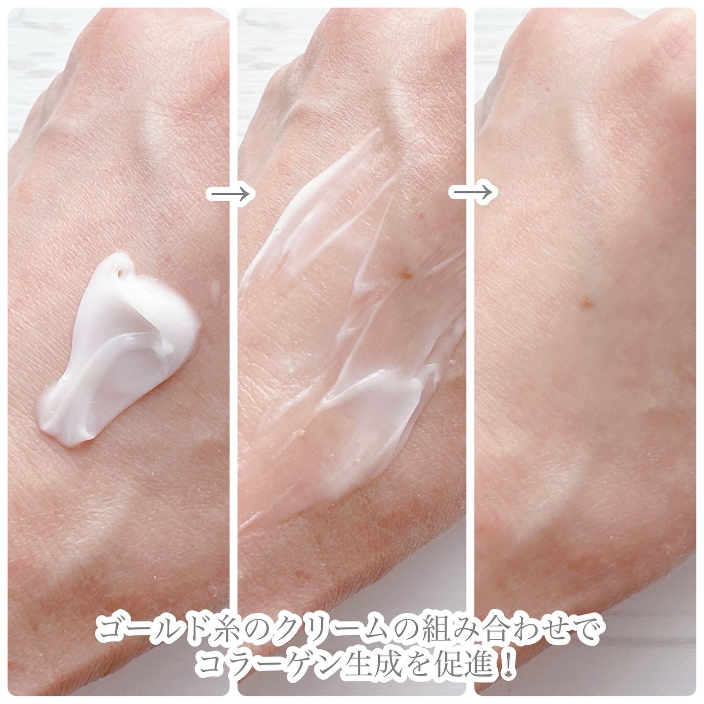 シューマジゴールド糸リフティングクリーム+EMS美顔器/MEDITHERAPY/フェイスクリームを使ったクチコミ(7枚目)