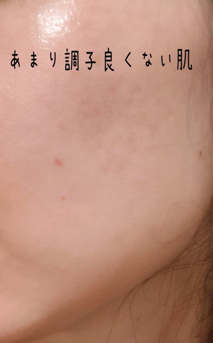 イハダ 薬用バーム【医薬部外品】/IHADA/フェイスバームを使ったクチコミ(1枚目)