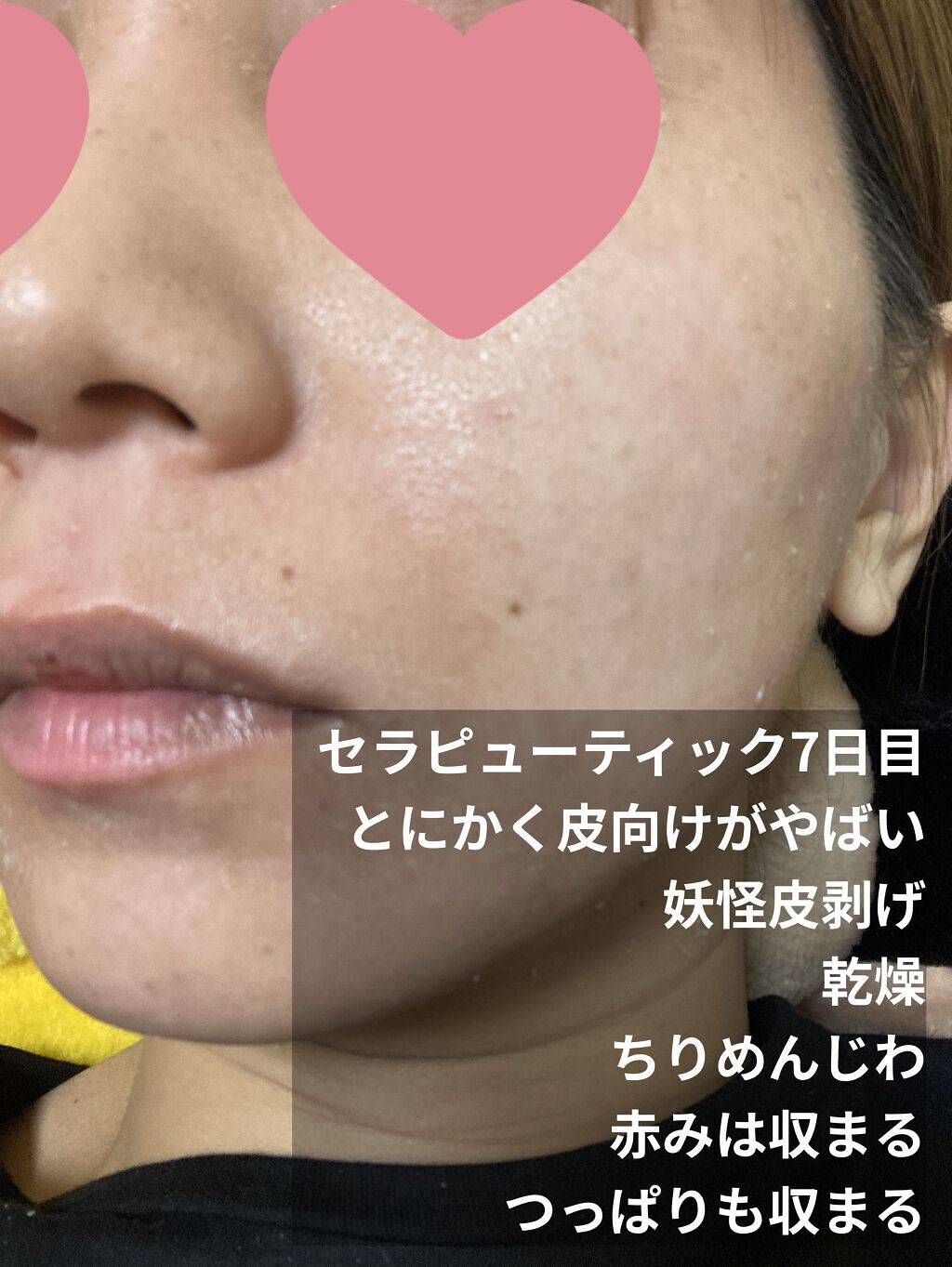 ミラミックス/ZO Skin Health/フェイスクリームを使ったクチコミ（2枚目）