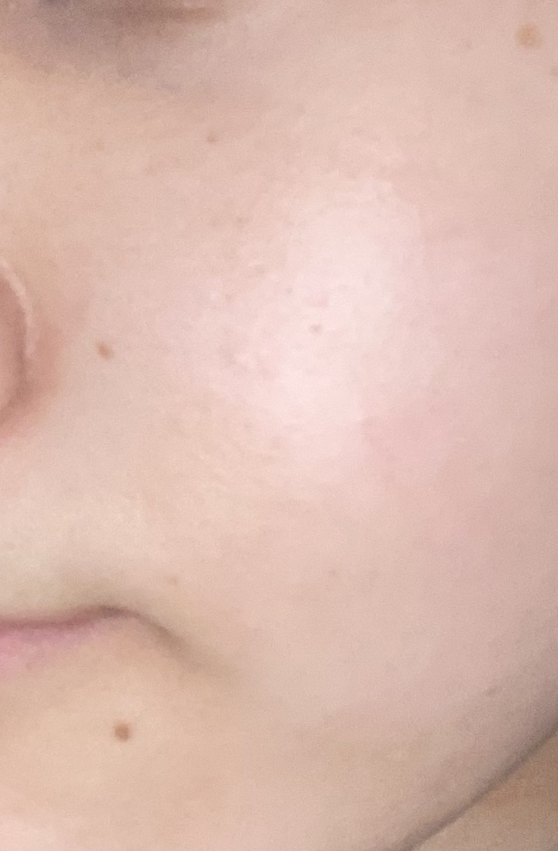 スキンリペアクリーム/d プログラム/フェイスクリームを使ったクチコミ（1枚目）