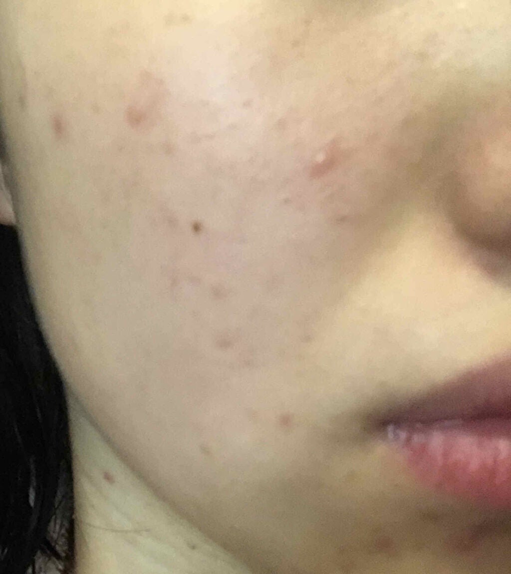 EclatCharme(エクラシャルム)/FABIUS/オールインワン化粧品を使ったクチコミ(3枚目)