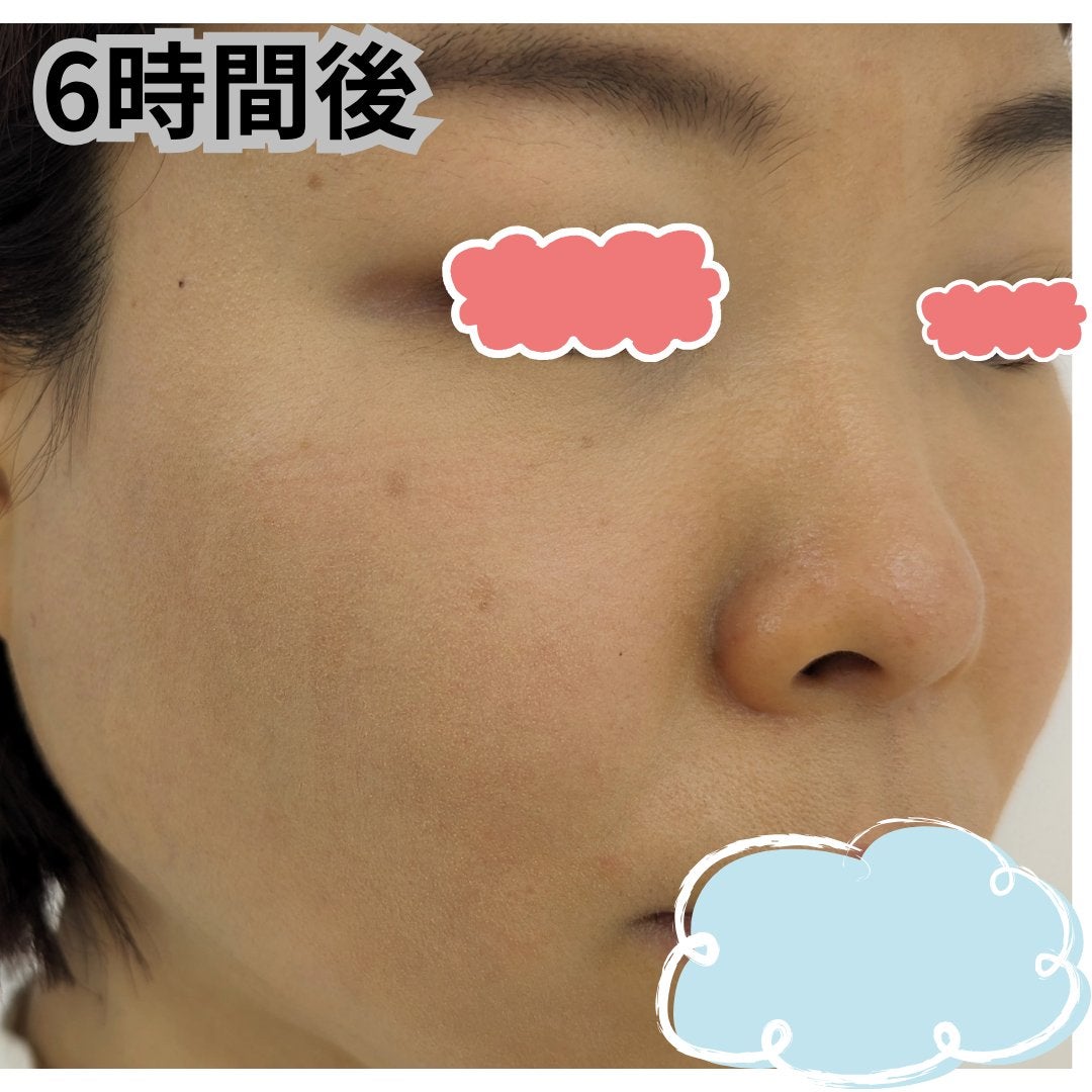 エッセンス スキングロウ ファンデーション/SHISEIDO/リキッドファンデーションを使ったクチコミ(2枚目)