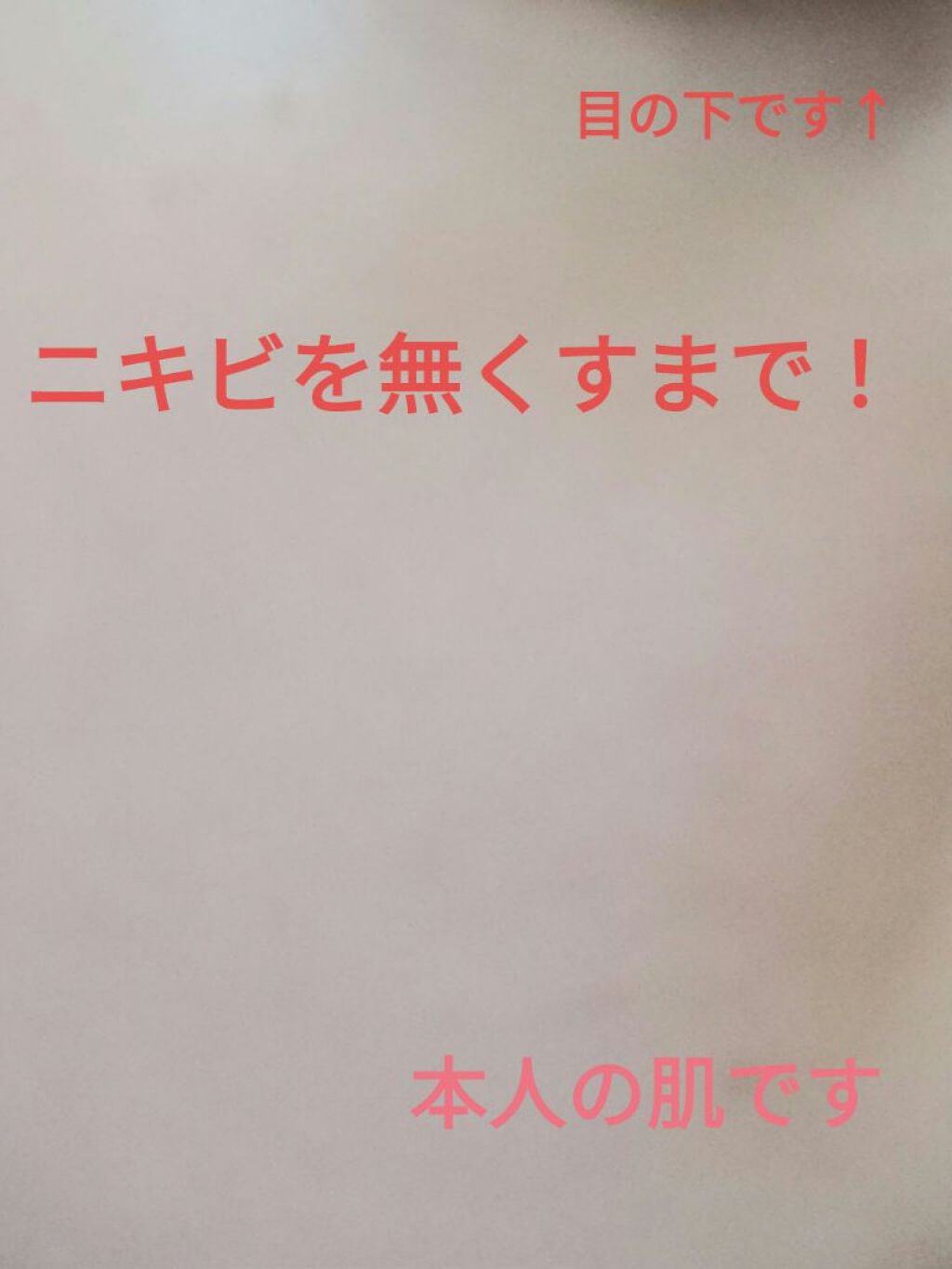 ハトムギ保湿ジェル(ナチュリエ スキンコンディショニングジェル)/ナチュリエ/美容液を使ったクチコミ(1枚目)