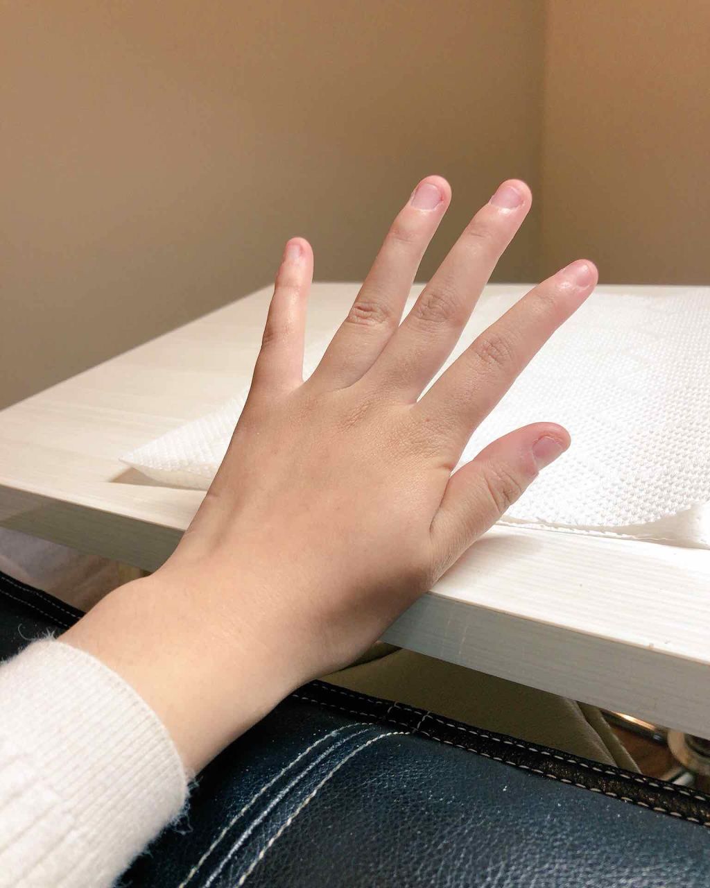 ひなの on LIPS 「※2枚目、醜い深爪の写真です私は、小さい頃から爪を噛む・剥くク..」(2枚目)