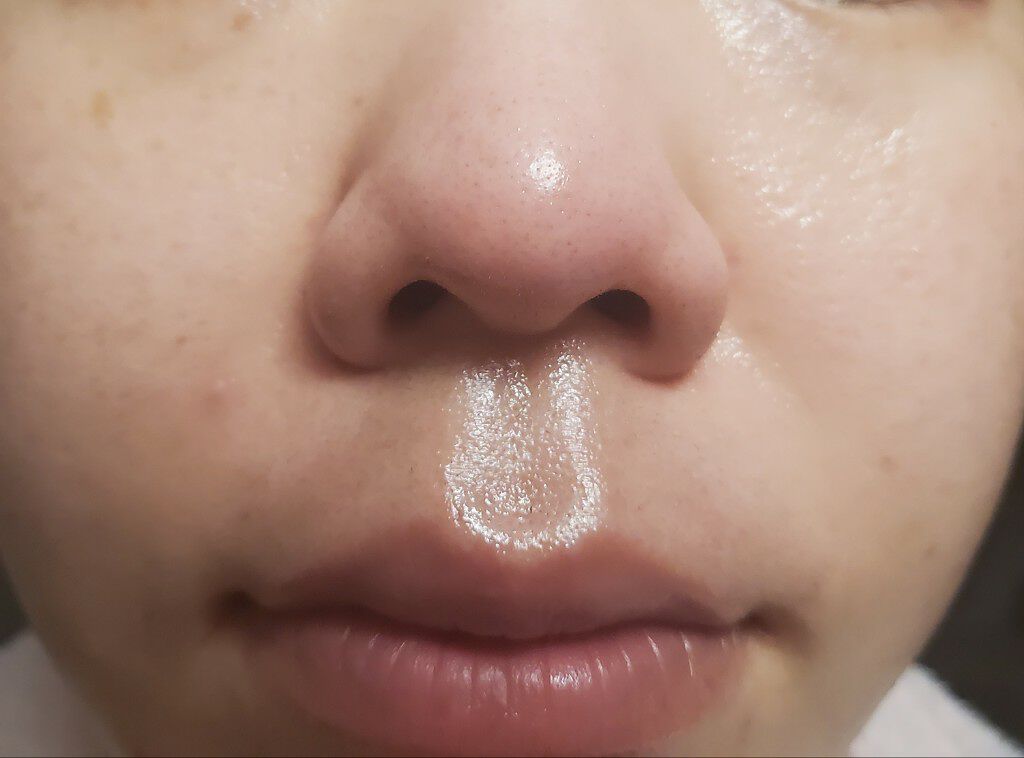 スキンコンディショナー ノーマルタイプ/ルナメアAC/化粧水を使ったクチコミ(1枚目)