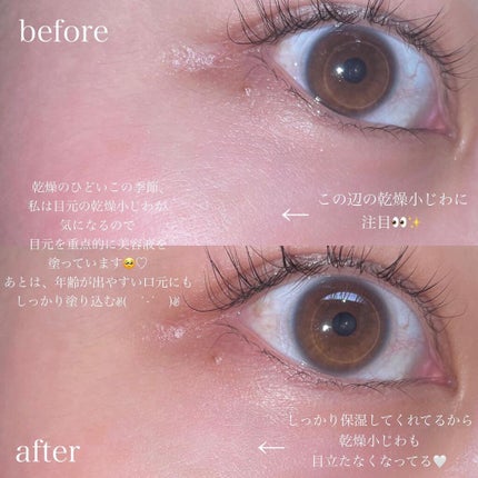 SHANON(シャノン) ロイヤルセラムのクチコミ「スキンケア_レポ
*
オタクが厳選配合にこだわって作った
自分史上最高の肌へ導いてくれる美容液.....」(3枚目)