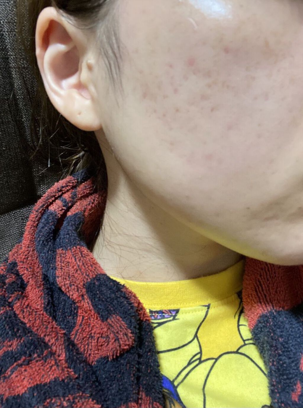 ホワイトニング ミスト セラム/アルージェ/ミスト状化粧水を使ったクチコミ（1枚目）