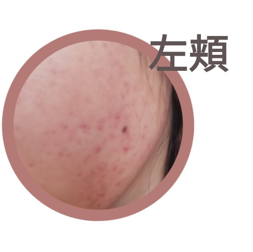 ハトムギ化粧水(ナチュリエ スキンコンディショナー R )/ナチュリエ/化粧水を使ったクチコミ（3枚目）