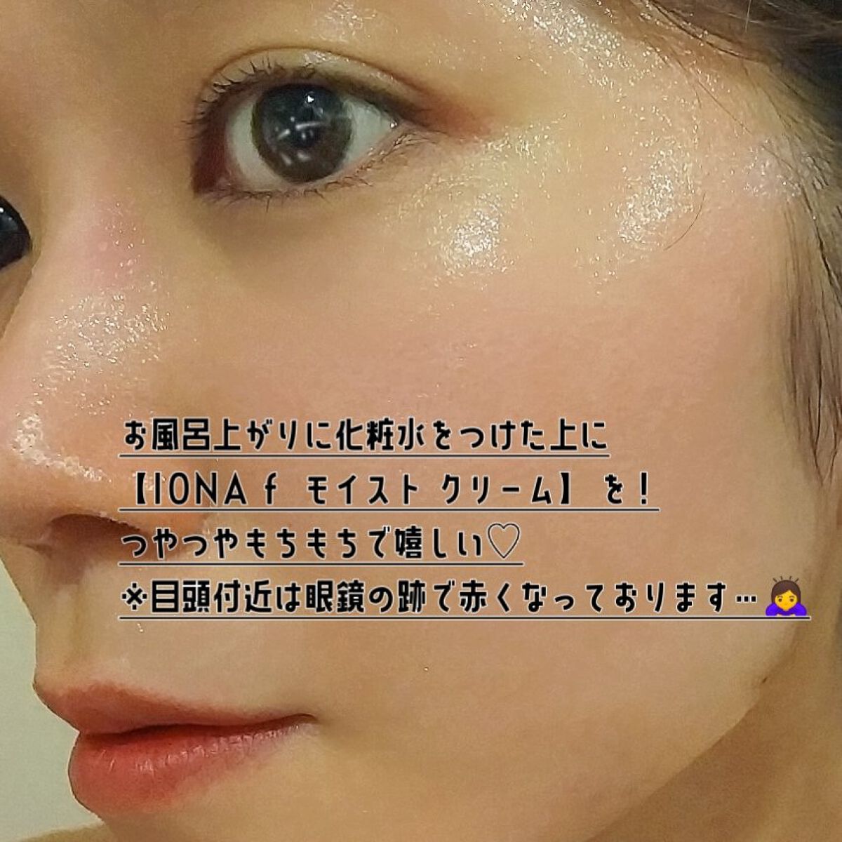 モイスト クリーム/イオナ エフ/フェイスクリームを使ったクチコミ(3枚目)