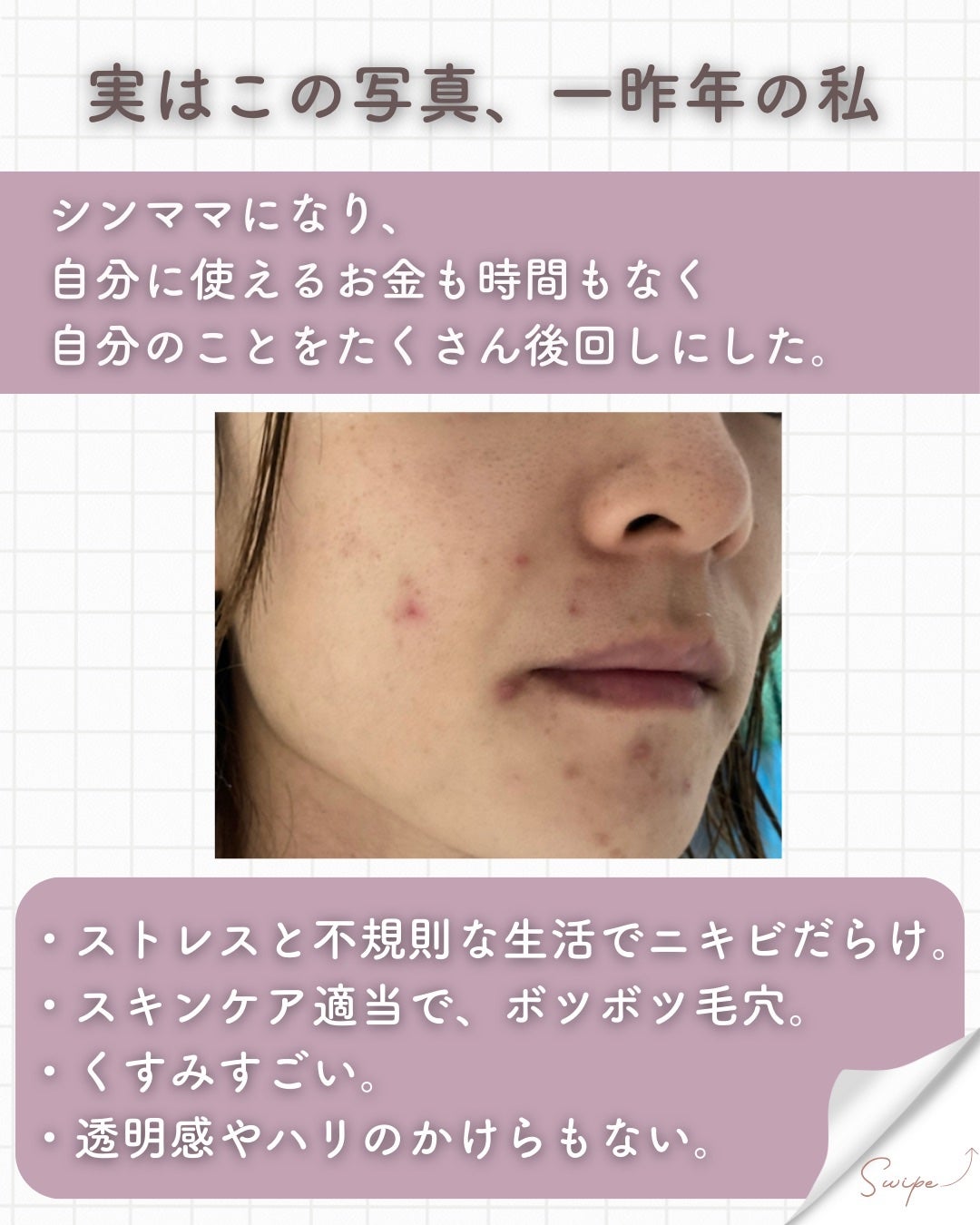 エッセンシャル トリートメントローション/ロベクチン/化粧水を使ったクチコミ(2枚目)