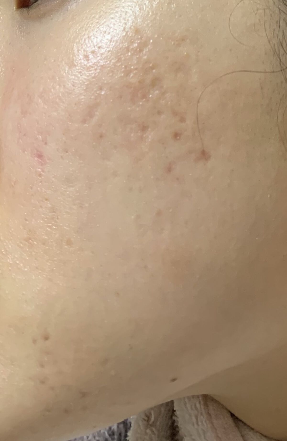 化粧水・敏感肌用・高保湿タイプ/無印良品/化粧水を使ったクチコミ（2枚目）