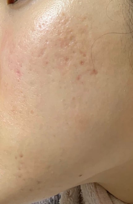 化粧水・敏感肌用・高保湿タイプ/無印良品/化粧水を使ったクチコミ(2枚目)