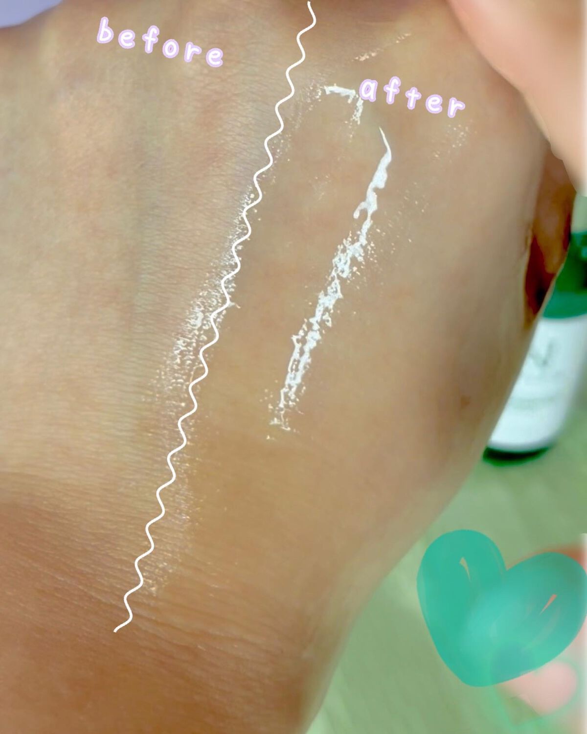 センテルカーミングショットアンプル/AMPLE:N/美容液を使ったクチコミ(5枚目)