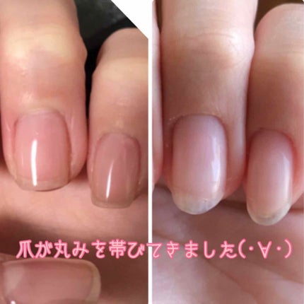 ネイル&キューティクルオイル/キューティクルズ/ハンドクリームを使ったクチコミ(2枚目)
