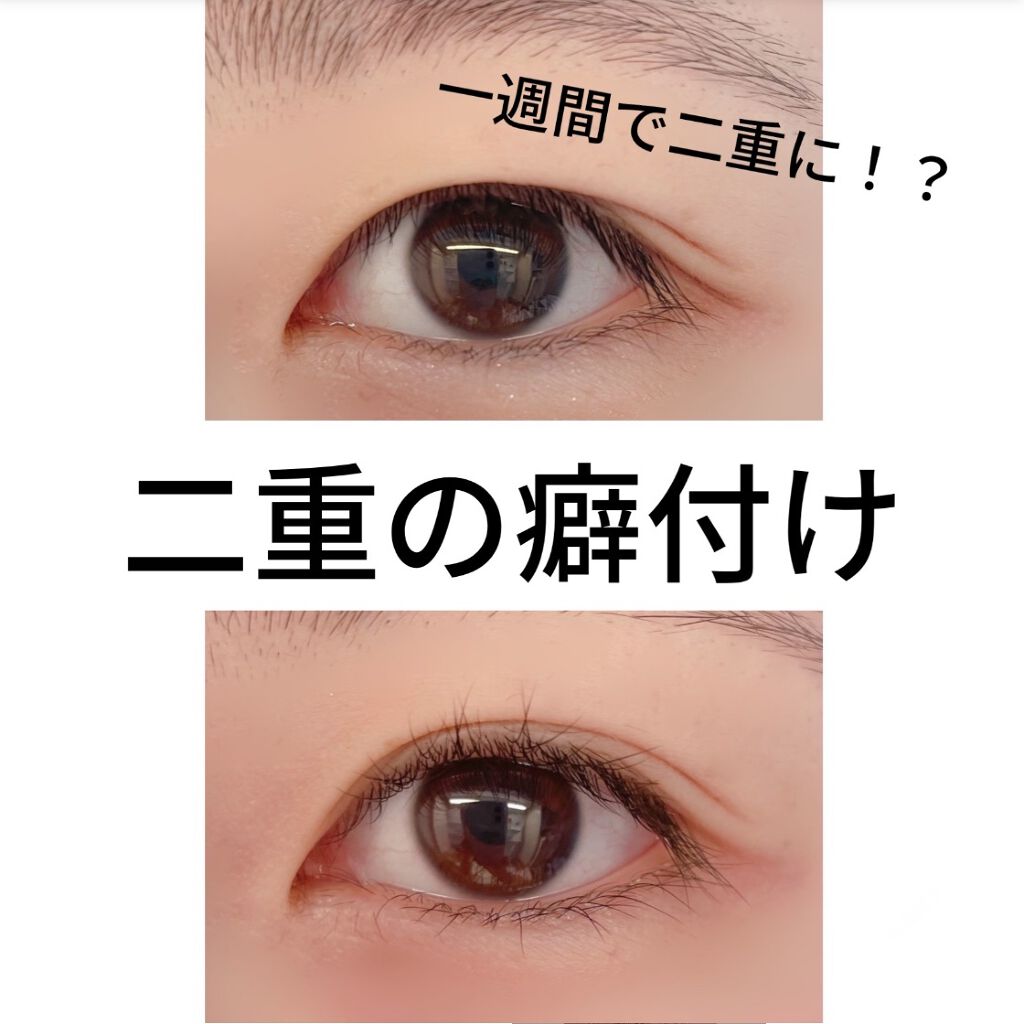 二重まぶた用シール/DAISO/二重まぶた用アイテムを使ったクチコミ（1枚目）