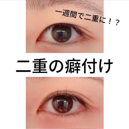 二重まぶた用シール/DAISO/二重まぶた用アイテムを使ったクチコミ(1枚目)