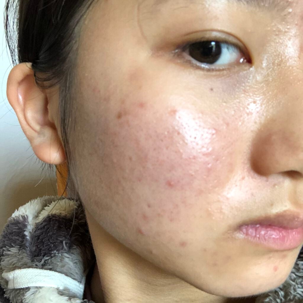 ディープモイスチャースプレー/キュレル/ミスト状化粧水を使ったクチコミ(2枚目)