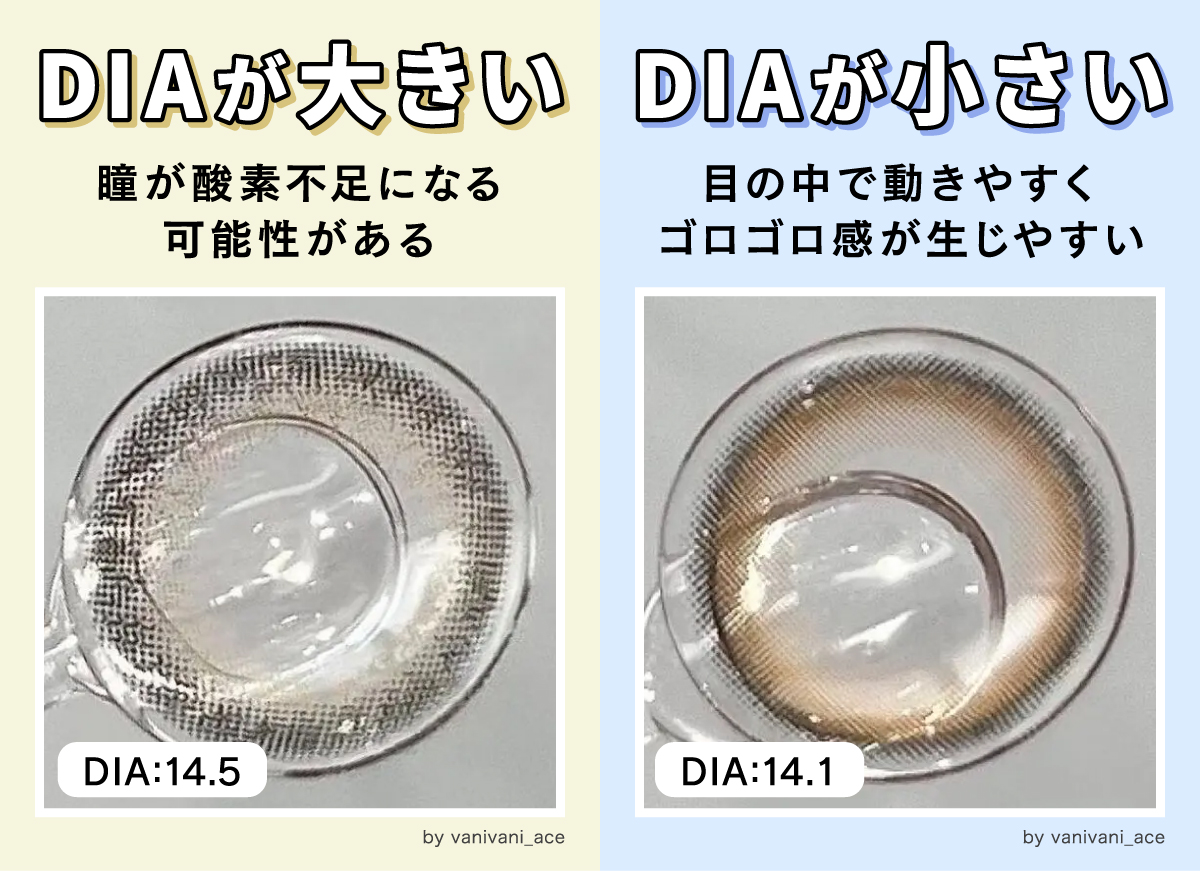 DIAが大きいと瞳が酸素不足になる可能性がありDIAが小さいと目の中で動きやすくゴロゴロ感が生じやすいです。