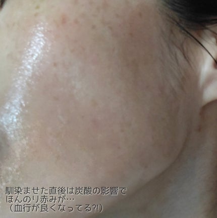 ザ ファーストエッセンス/ALBLANC/美容液を使ったクチコミ(4枚目)