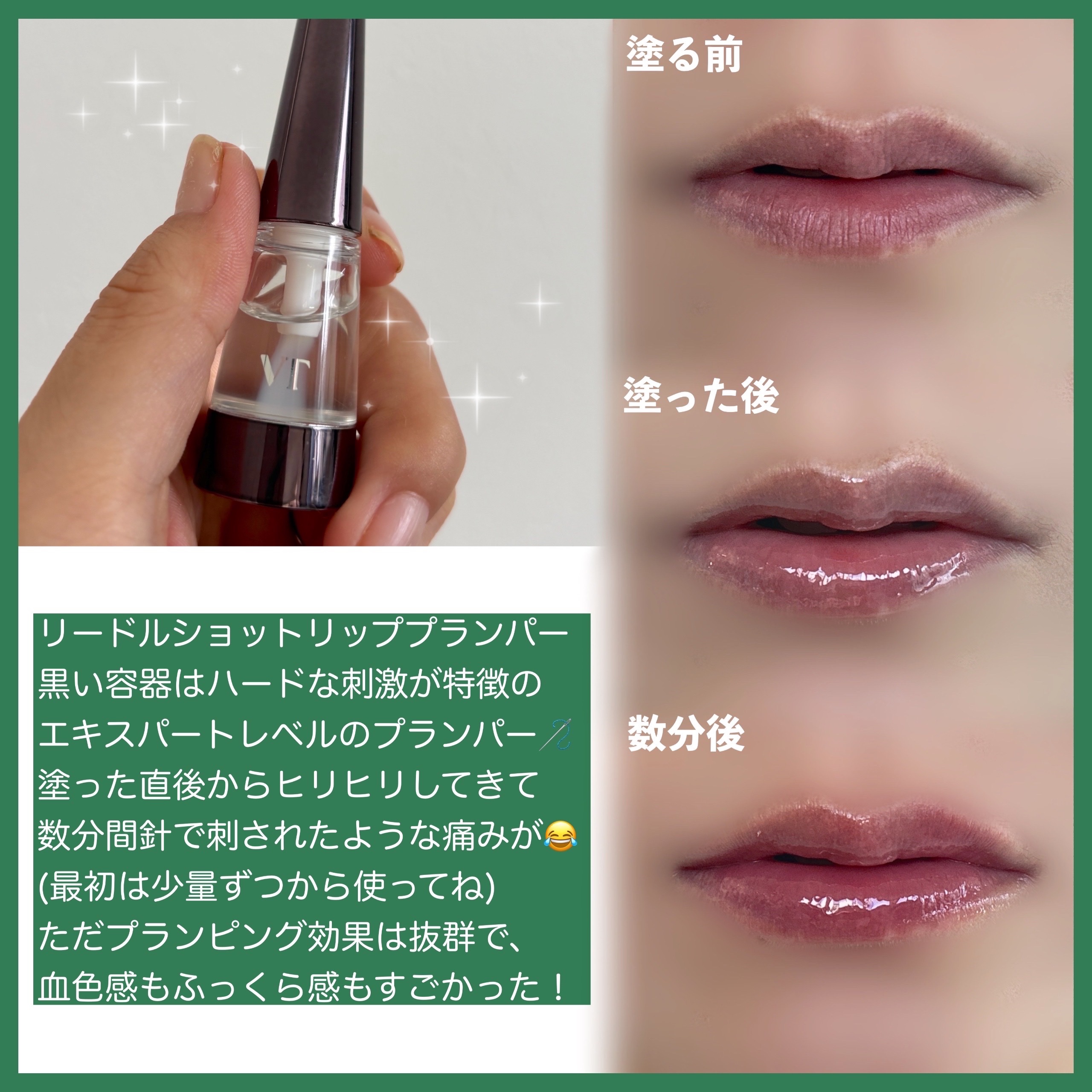 リードルS リッププランパービギナー/VT/リッププランパーを使ったクチコミ（3枚目）