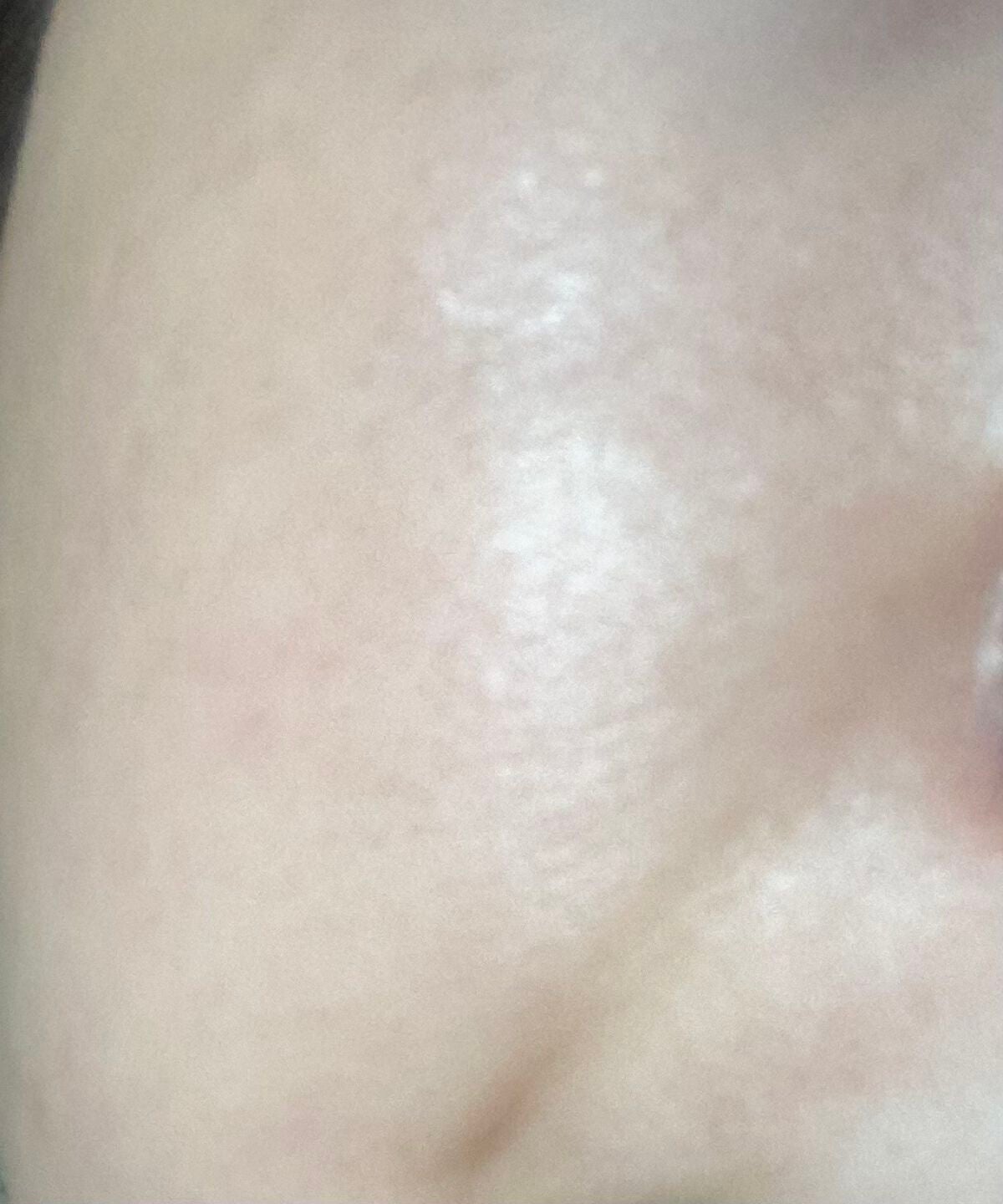 レチノールA 1% アドバンスドリバイタリゼーションクリーム/Life-flo/フェイスクリームを使ったクチコミ(5枚目)