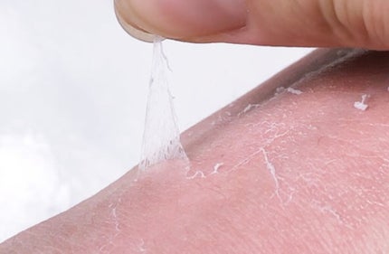 Real Skin Patch/NOT4U/その他を使ったクチコミ(3枚目)