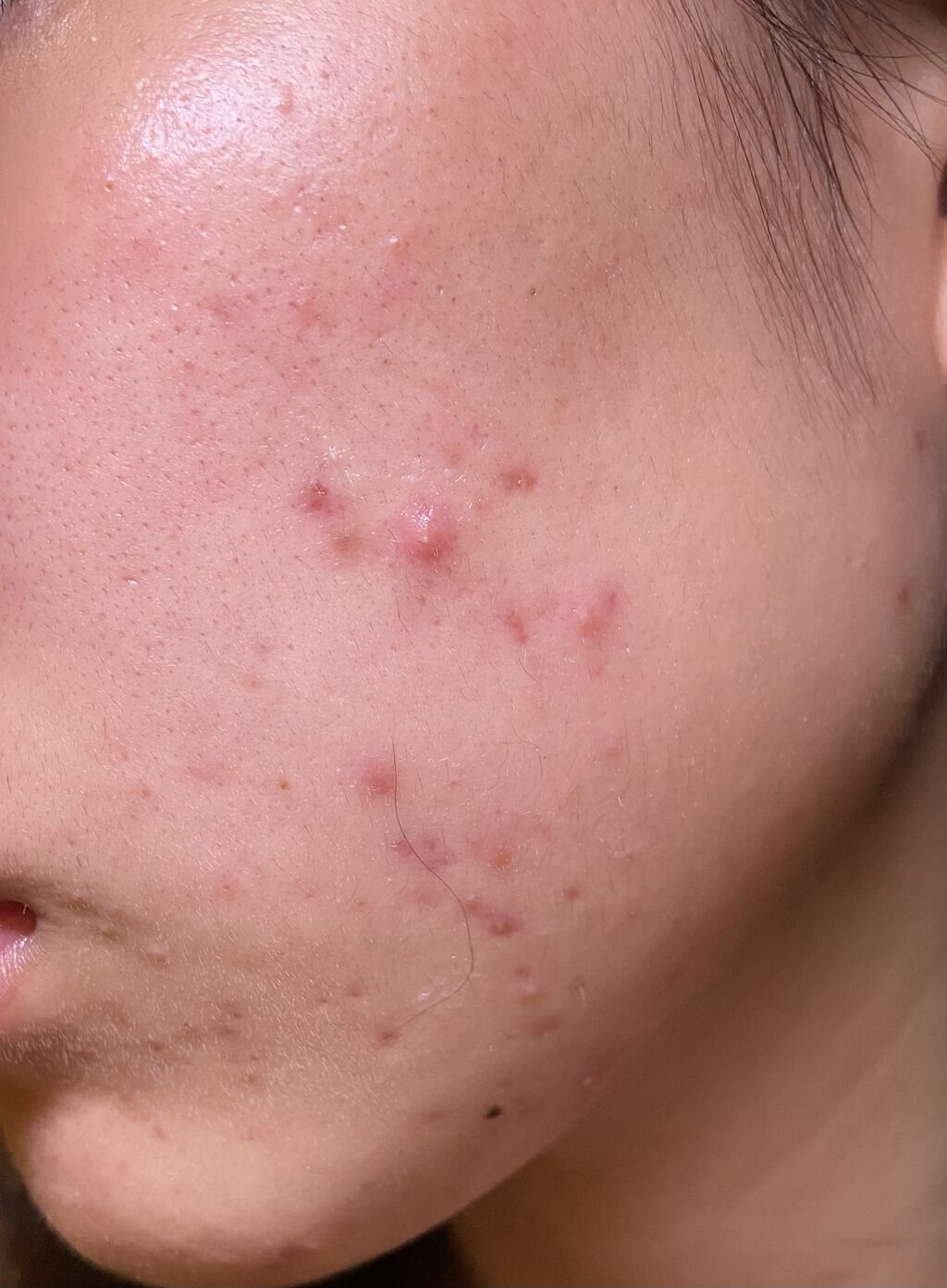 潤浸保湿 フェイスクリーム/キュレル/フェイスクリームを使ったクチコミ（3枚目）