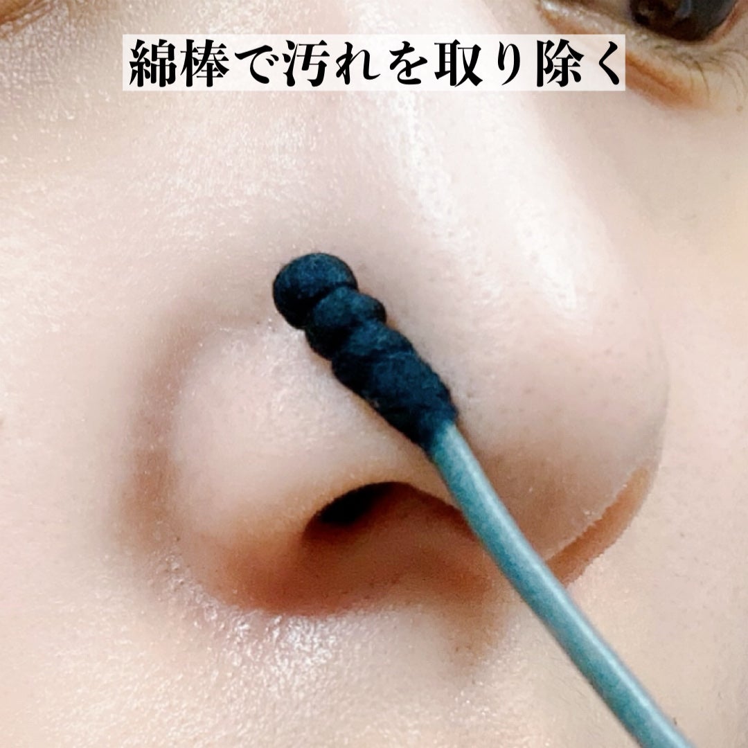 アンチポアブラックヘッドパーフェクトクリアキット/CNP Laboratory/シートマスク・パックを使ったクチコミ(5枚目)