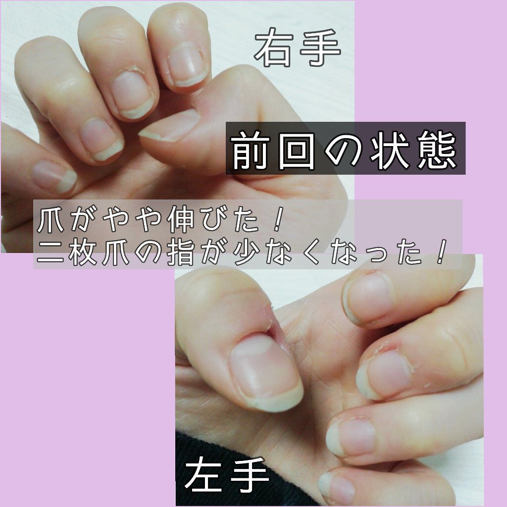 爪磨き/キャンドゥ/ネイル用品を使ったクチコミ（2枚目）