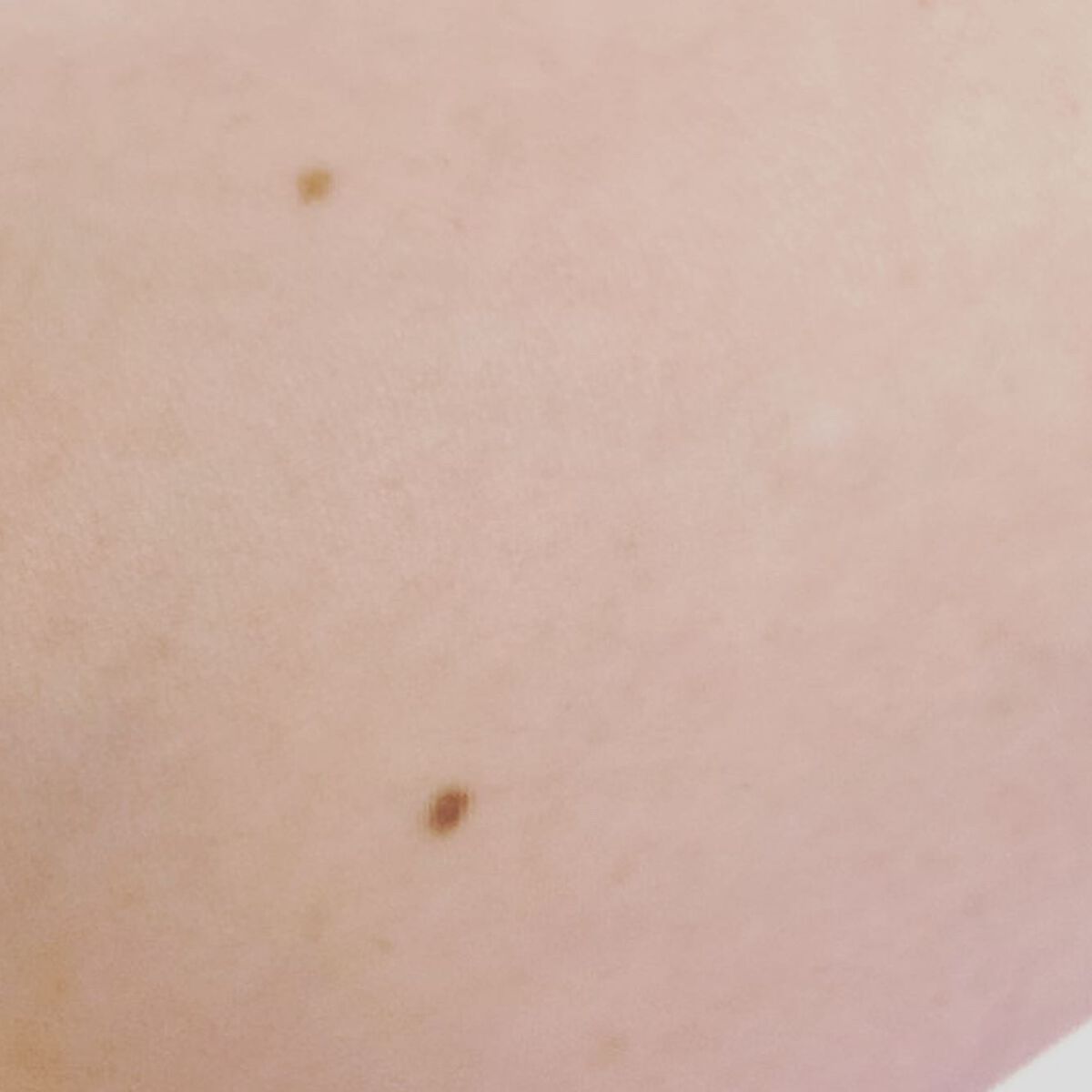 コンシーラー(シミ・ソバカス用) ライトベージュ/グレイシィ/スティックコンシーラーを使ったクチコミ（2枚目）