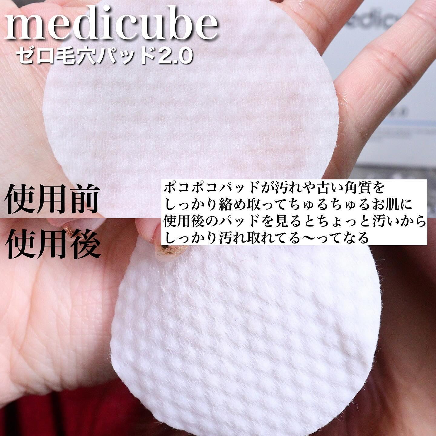ゼロ毛穴パッド 2.0/MEDICUBE/トナーパッドを使ったクチコミ（3枚目）