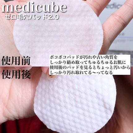 ゼロ毛穴パッド 2.0/MEDICUBE/トナーパッドを使ったクチコミ(3枚目)