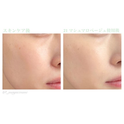 ダーマシンコンシーラー/23years old/リキッドコンシーラーを使ったクチコミ(5枚目)