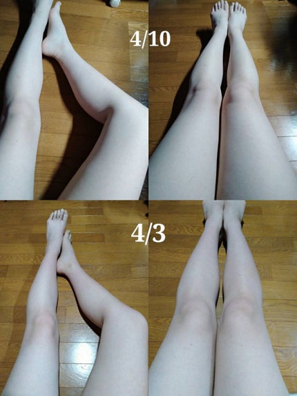 寝ながらメディキュット フルレッグ/メディキュット/着圧ソックス・レギンスを使ったクチコミ(2枚目)