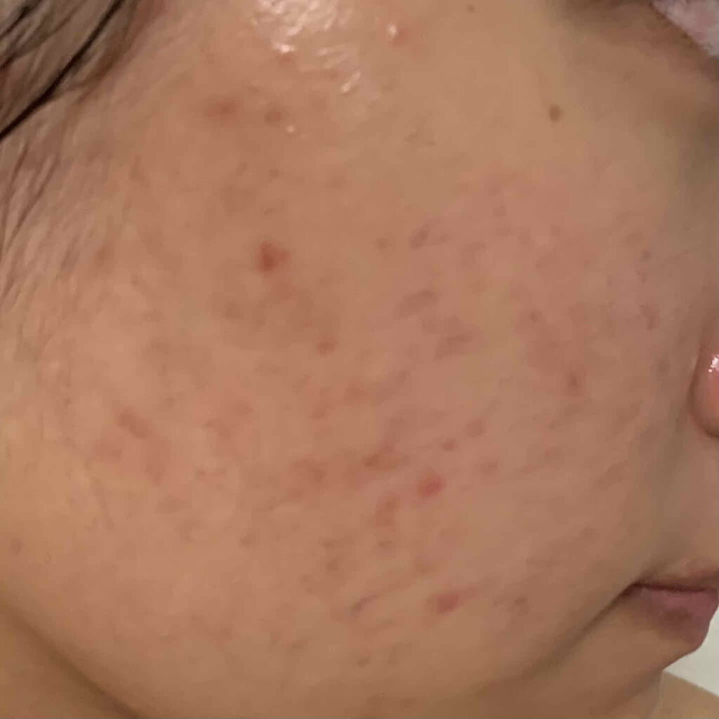 クリアウォッシュ/オルビス/洗顔フォームを使ったクチコミ（2枚目）