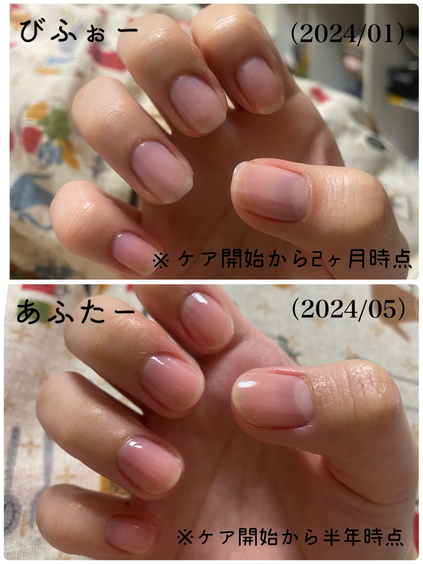 夏秋 on LIPS 「(育爪日記#2)ケア開始から半年が経っていたので記録用に並べて..」(3枚目)