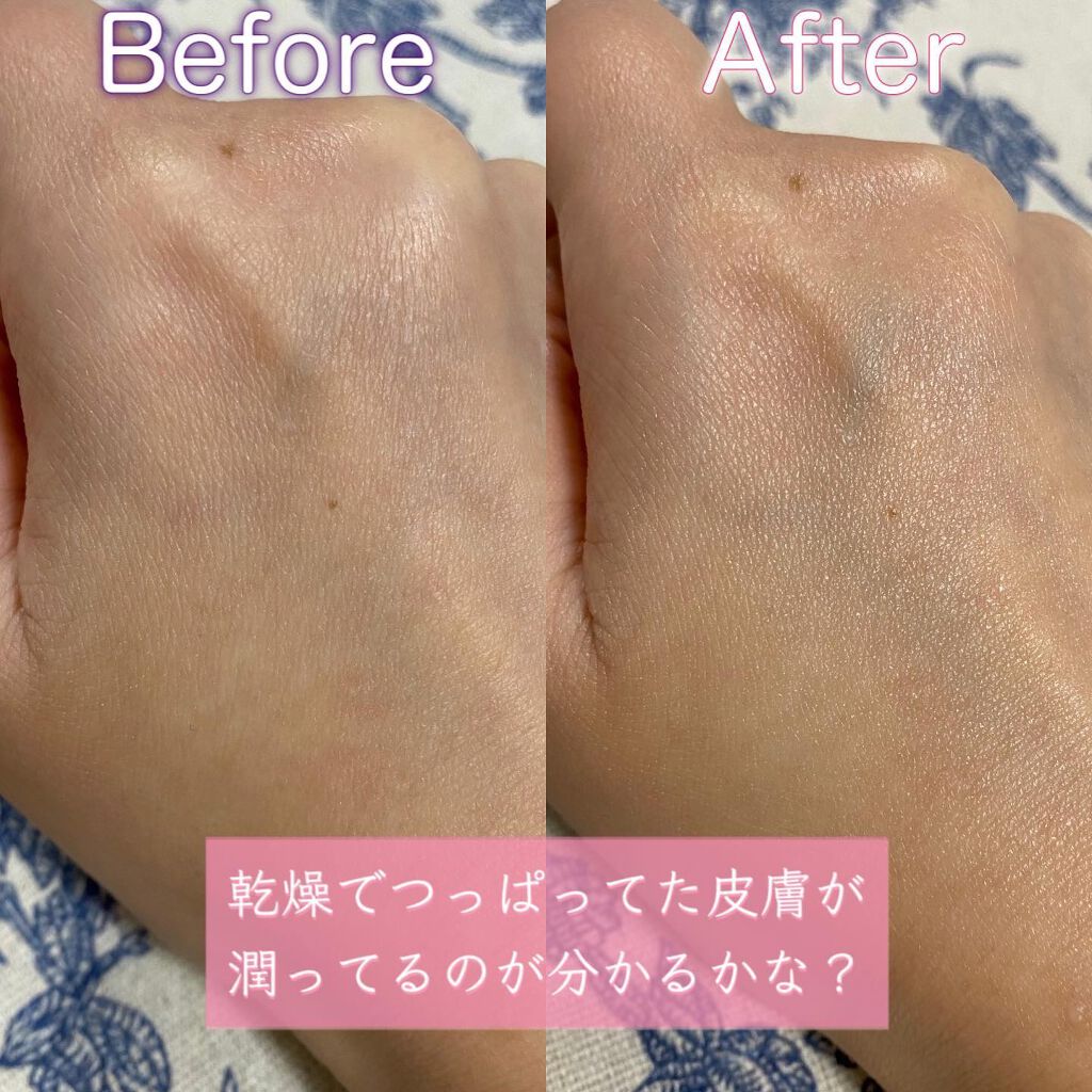 アトバリア365クリーム/AESTURA/フェイスクリームを使ったクチコミ(4枚目)