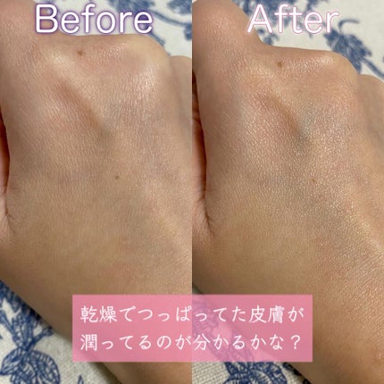 アトバリア365クリーム/AESTURA/フェイスクリームを使ったクチコミ(4枚目)