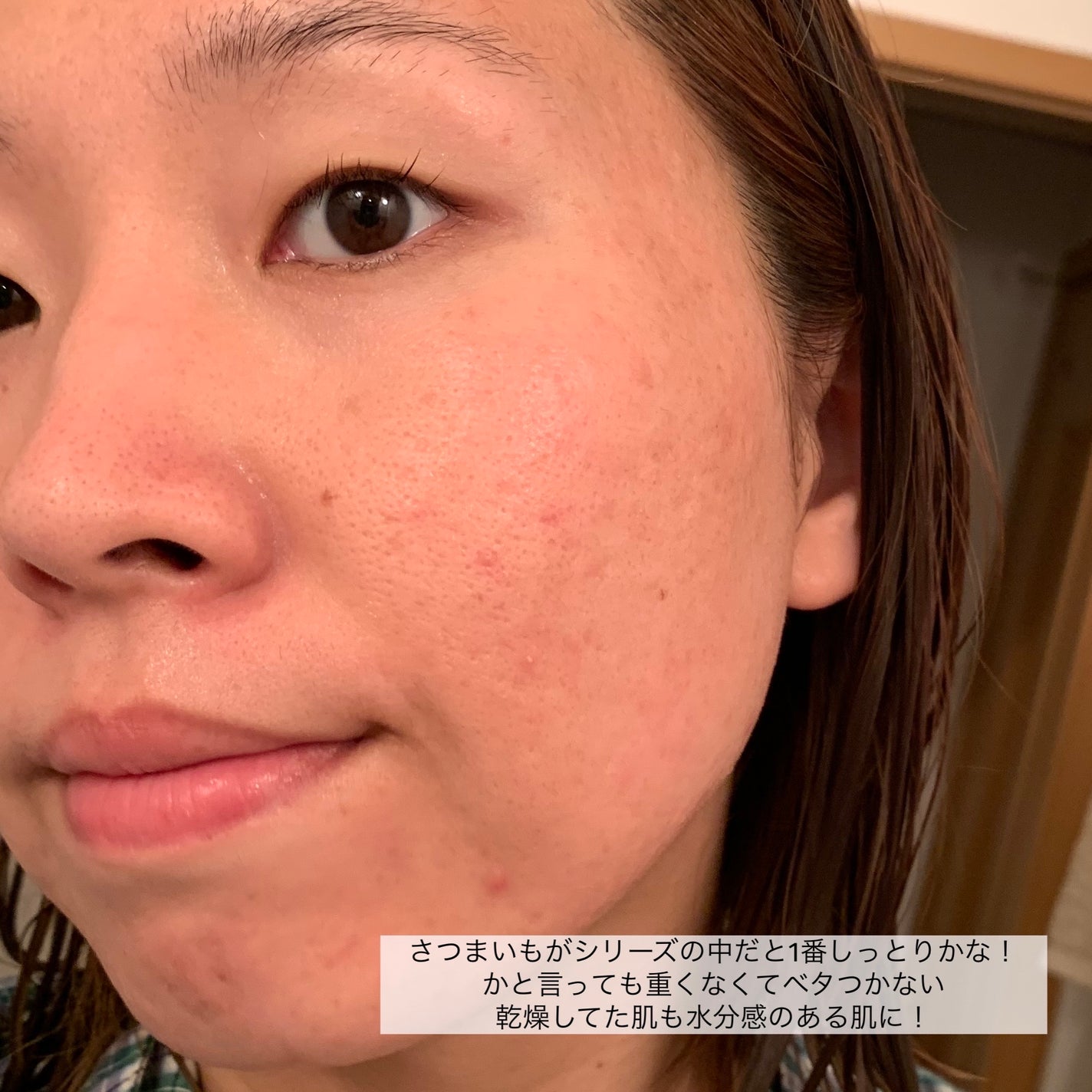 美肌の貯蔵庫 根菜の濃縮マスク 安納いも/@cosme nippon/シートマスク・パックを使ったクチコミ(5枚目)