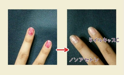 エルファー ネイルキッスC/DAISO/除光液を使ったクチコミ(4枚目)