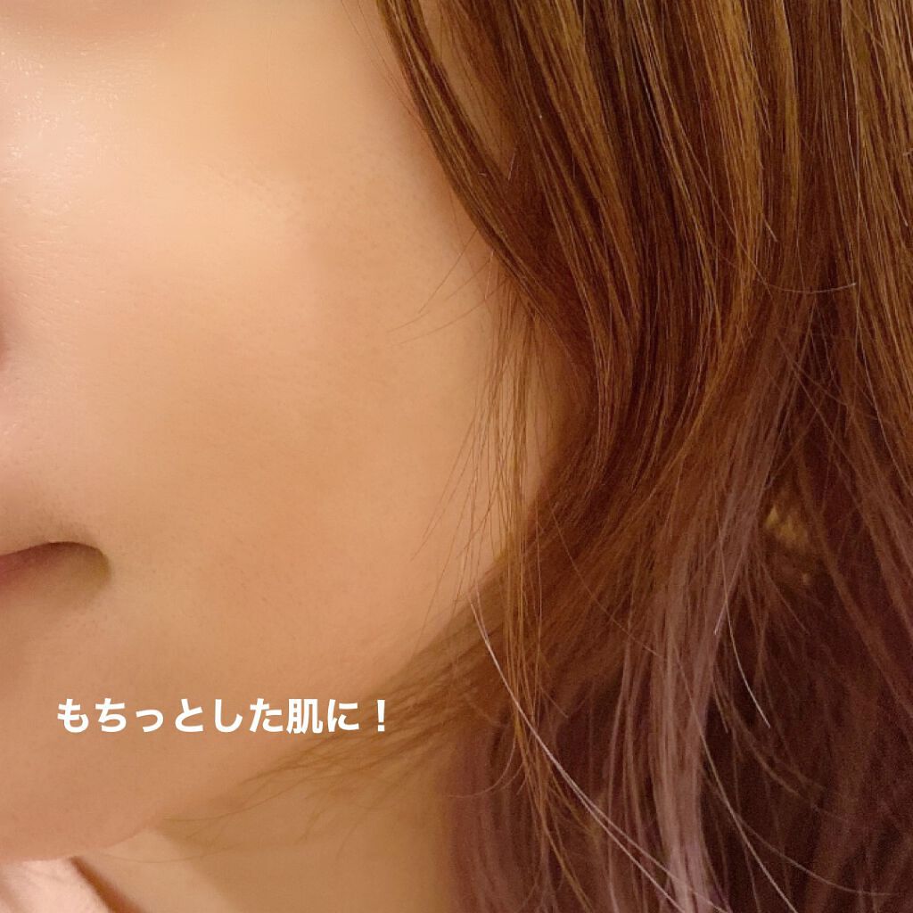 フルフィットプロポリスシナジートナー/COSRX/化粧水を使ったクチコミ(5枚目)