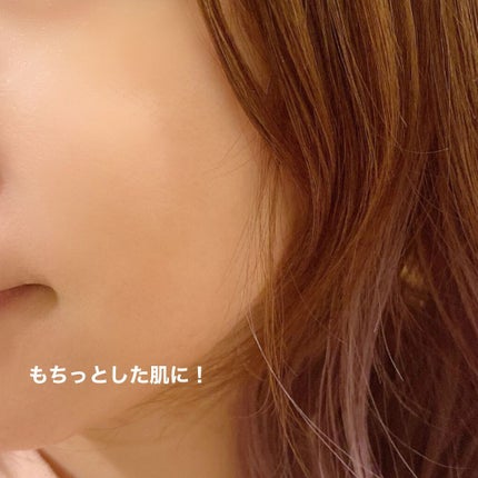 フルフィットプロポリスシナジートナー/COSRX/化粧水を使ったクチコミ(5枚目)