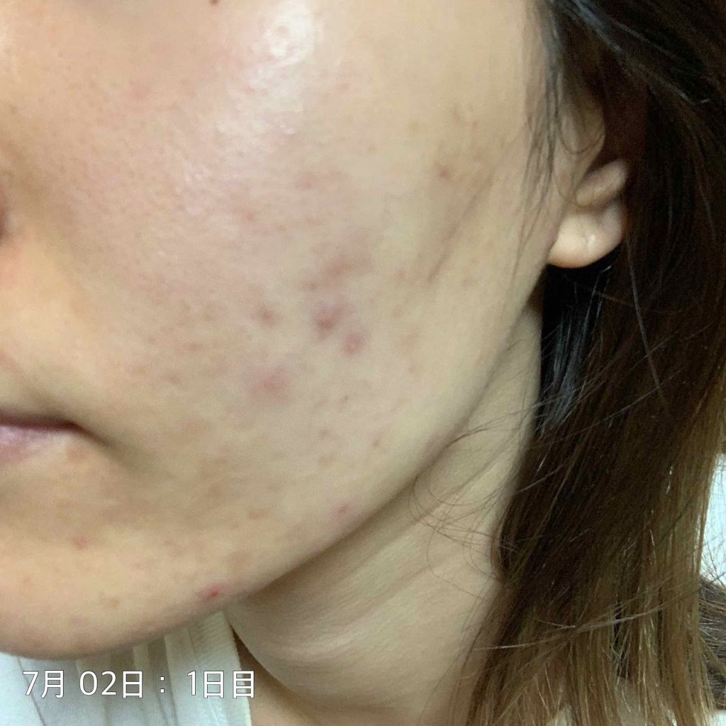 ハトムギ保湿ジェル(ナチュリエ スキンコンディショニングジェル)/ナチュリエ/美容液を使ったクチコミ（2枚目）