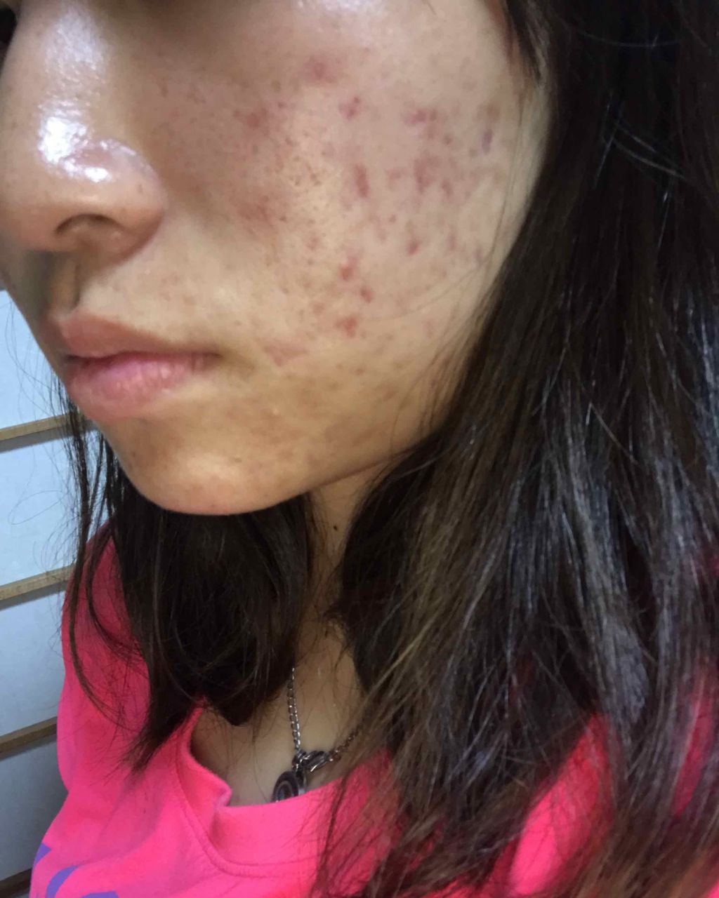 ポム on LIPS 「な、治ってませんか?..」(2枚目)