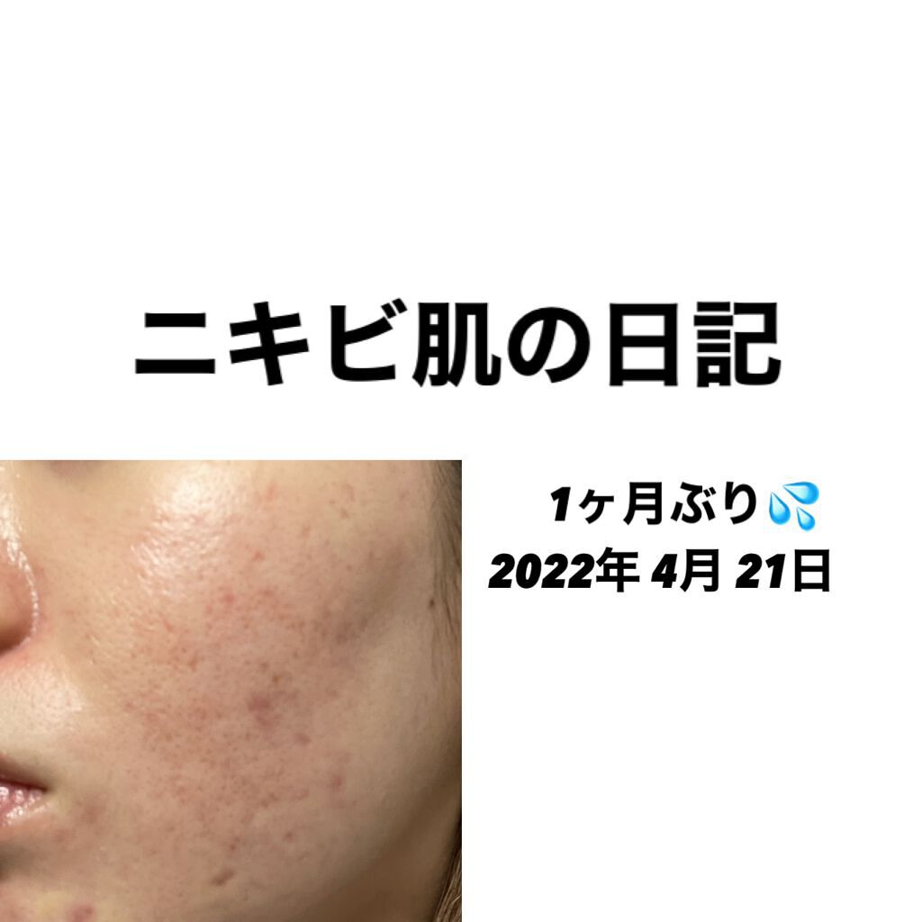 スキンケア洗顔料 モイスチャー/ビオレ/洗顔フォームを使ったクチコミ（1枚目）